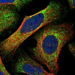 FAM53B Antibody, Novus Biologicals 25 &mu;L; Unlabeled:Antibodies, Polyclonal